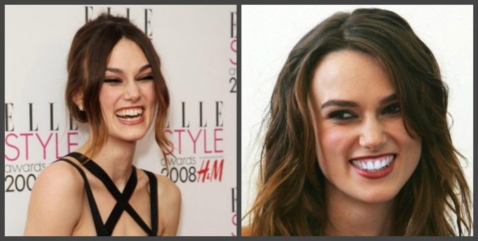 I denti di Keira Knightley prima e sul campo