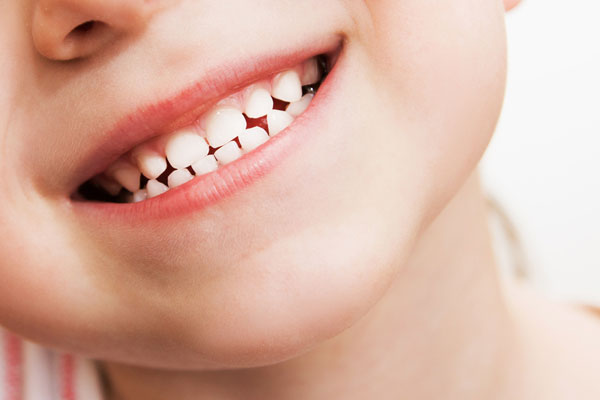 Caratteristiche e benefici del trattamento dei denti da latte per bambini
