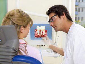 Descrizione dei fattori che contribuiscono alla formazione della carie dentale
