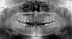 Istantanea digitale dei denti
