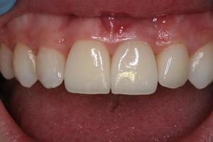 Caratteristiche della struttura istologica dei denti umani
