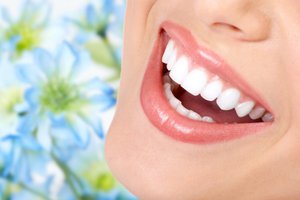 L'elenco dei vantaggi della fluorizzazione profonda