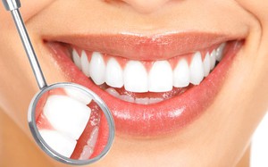 Consigli del dentista su come fluidificare meglio i denti