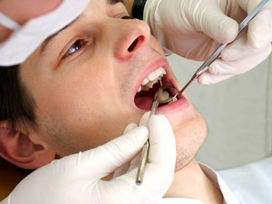 Metodi di trattamento delle cisti dei denti