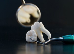 Cosa fare se un dente del giudizio fa male Odontoiatria a Mosca, dove è possibile rimuovere un dente del giudizio