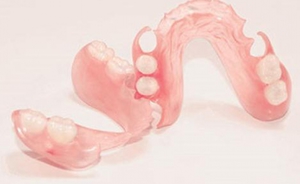Svantaggi delle protesi in nylon
