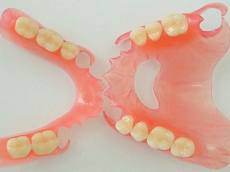 Per quanto tempo vengono realizzate le protesi in nylon