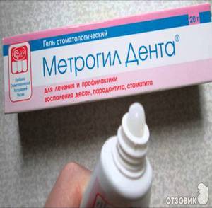 Metrogil in odontoiatria