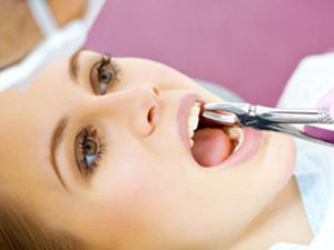 Il metodo di estrazione dei denti e le ragioni per questo