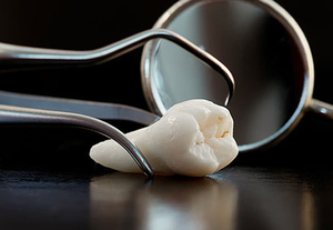 I sintomi della malattia dei denti del giudizio