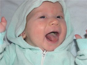 Che aspetto ha un mughetto nella fase iniziale? Sintomi dell'inizio della malattia fungina