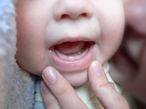 Primi denti da latte