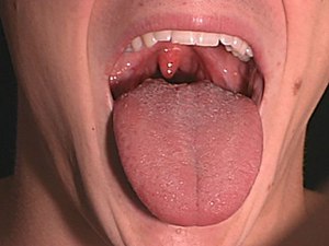 Come curare la mucosa orale