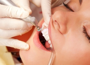 Trattamento dentale in clinica