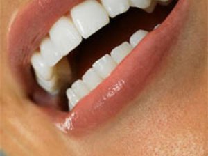 Misure preventive dopo il trattamento